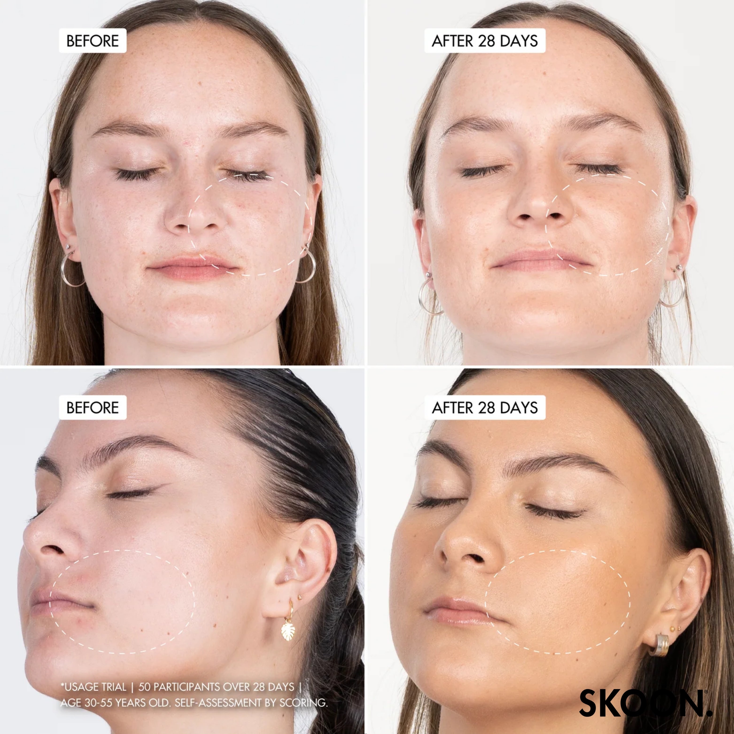 SKOON - NanoPillow Hydrosurge Duo Pack