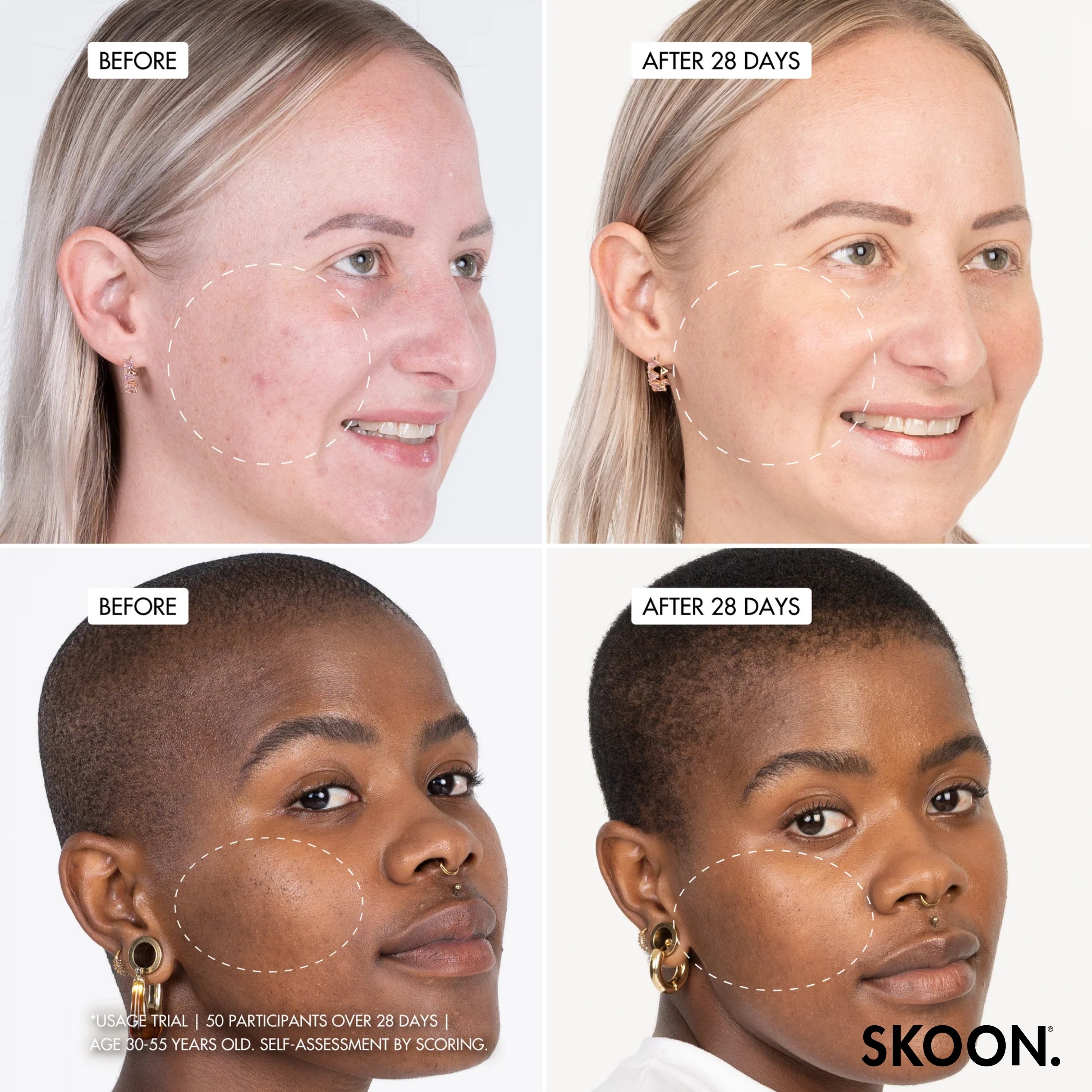 SKOON - Wow Wow Wonder + Nanopillow Serum 30g
