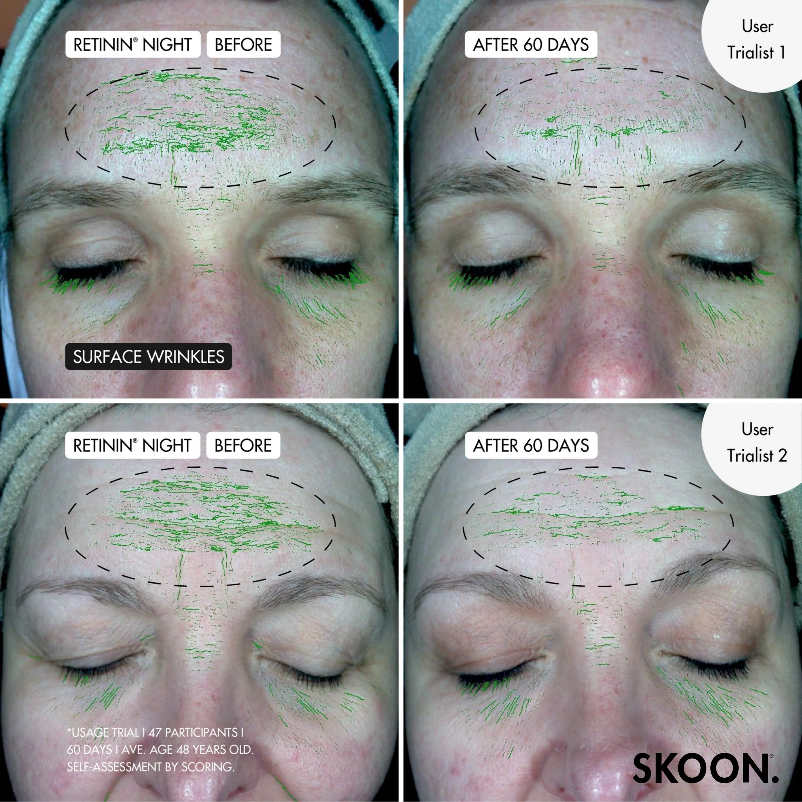SKOON - Triple Threat (Retinin Night + WWW + Skin PJs)