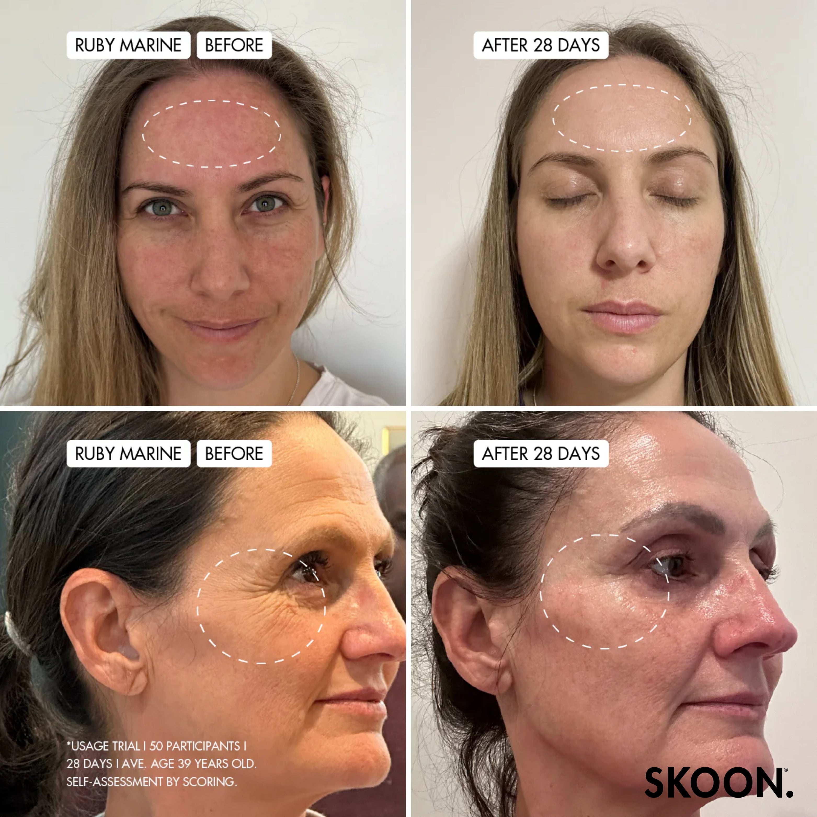 SKOON - Patch Things Up Combination (Dry Patches) + Sensitive Skin Set