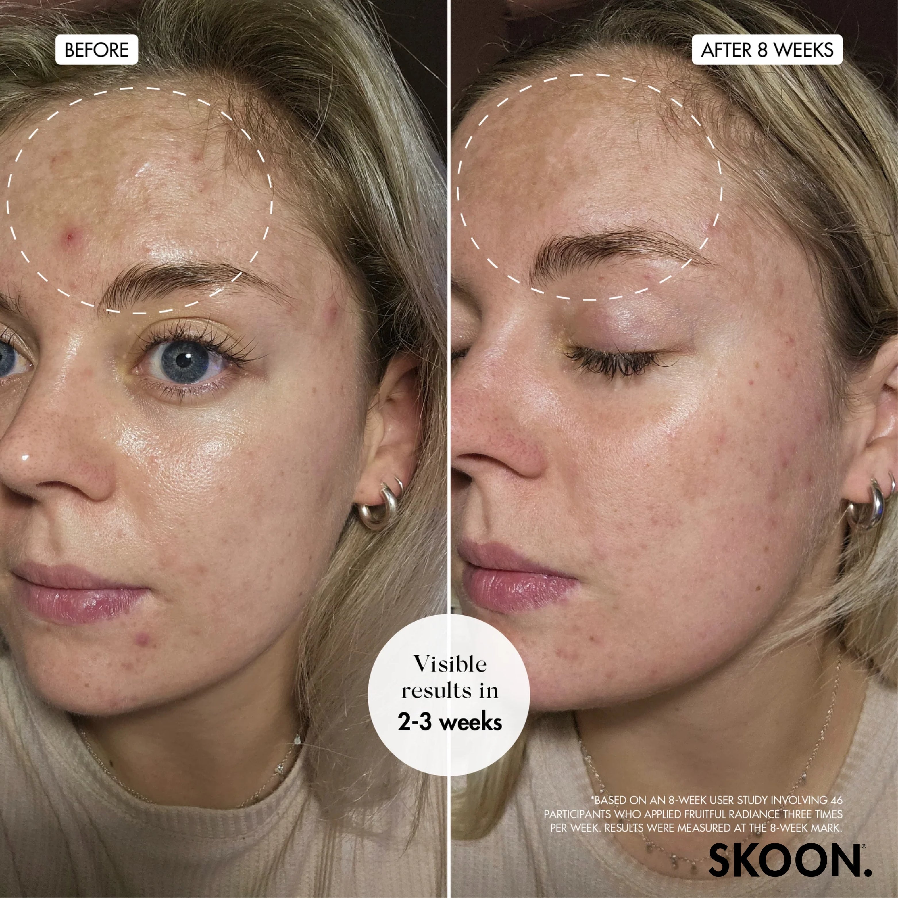 SKOON - Fruitful Radiance Renewal Night Liquid Exfoliant 100ml
