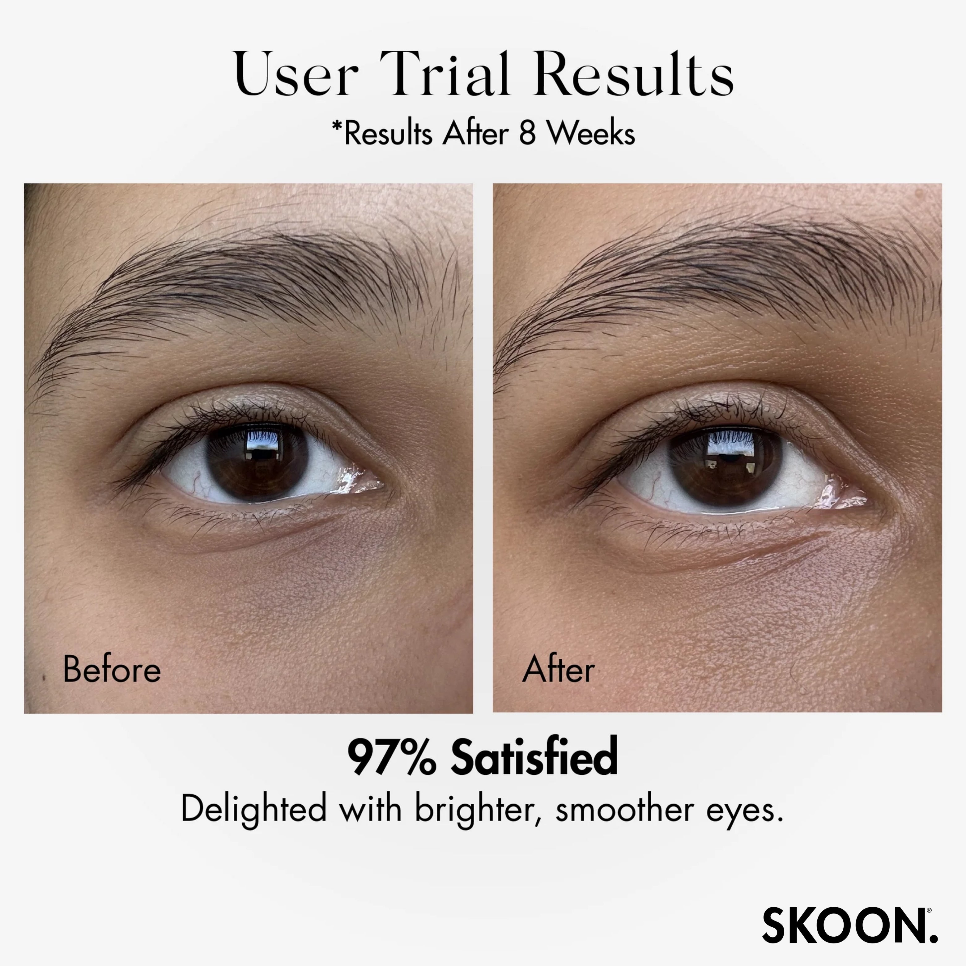 SKOON - Bright-Eyed Brighten + Firm Eye Cream 15ml