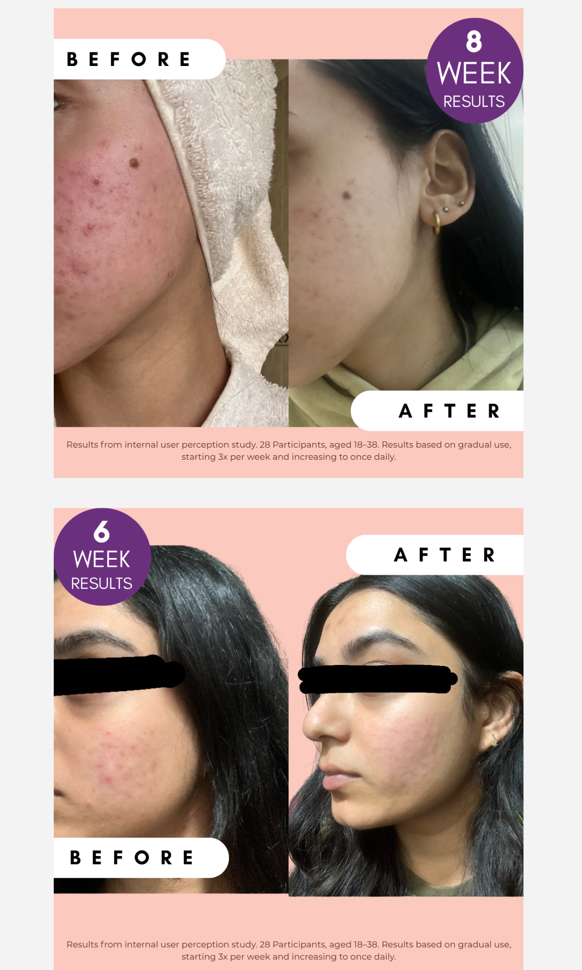 Standard Beauty - Pigmentation Buster Duo 60ml