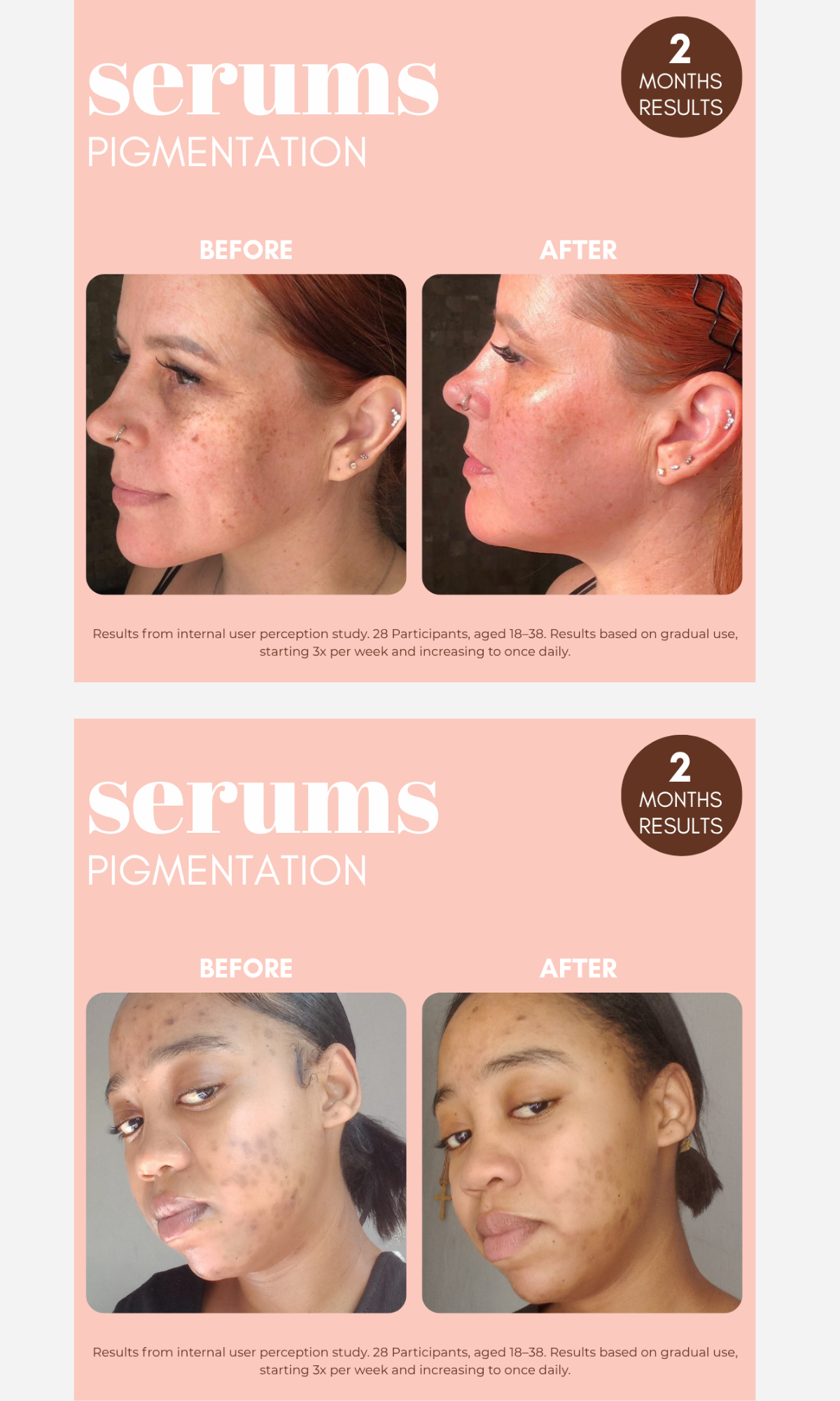 Standard Beauty - Pigmentation Buster Duo 60ml