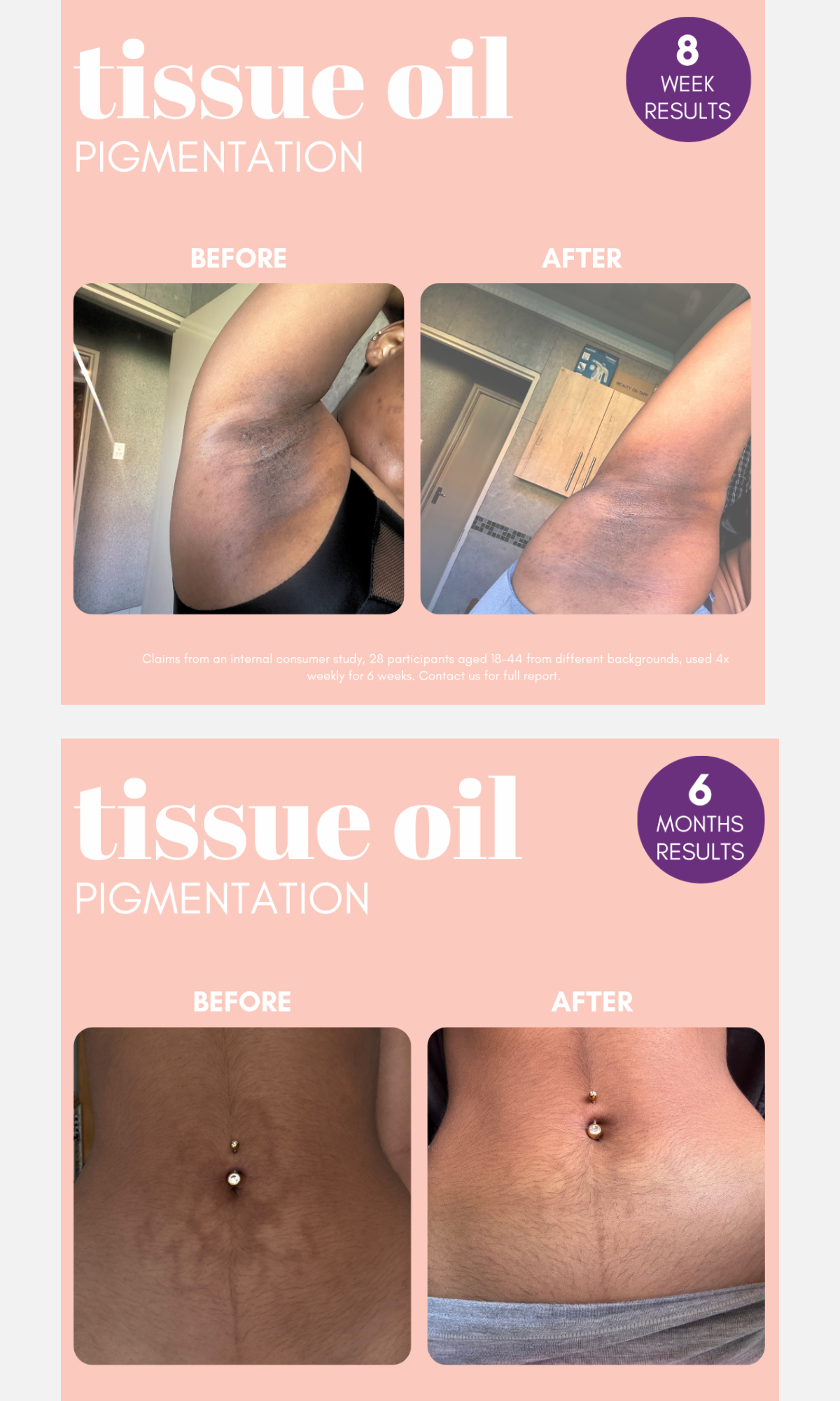 Standard Beauty - Pigmentation Buster Tissue Oil 100ml