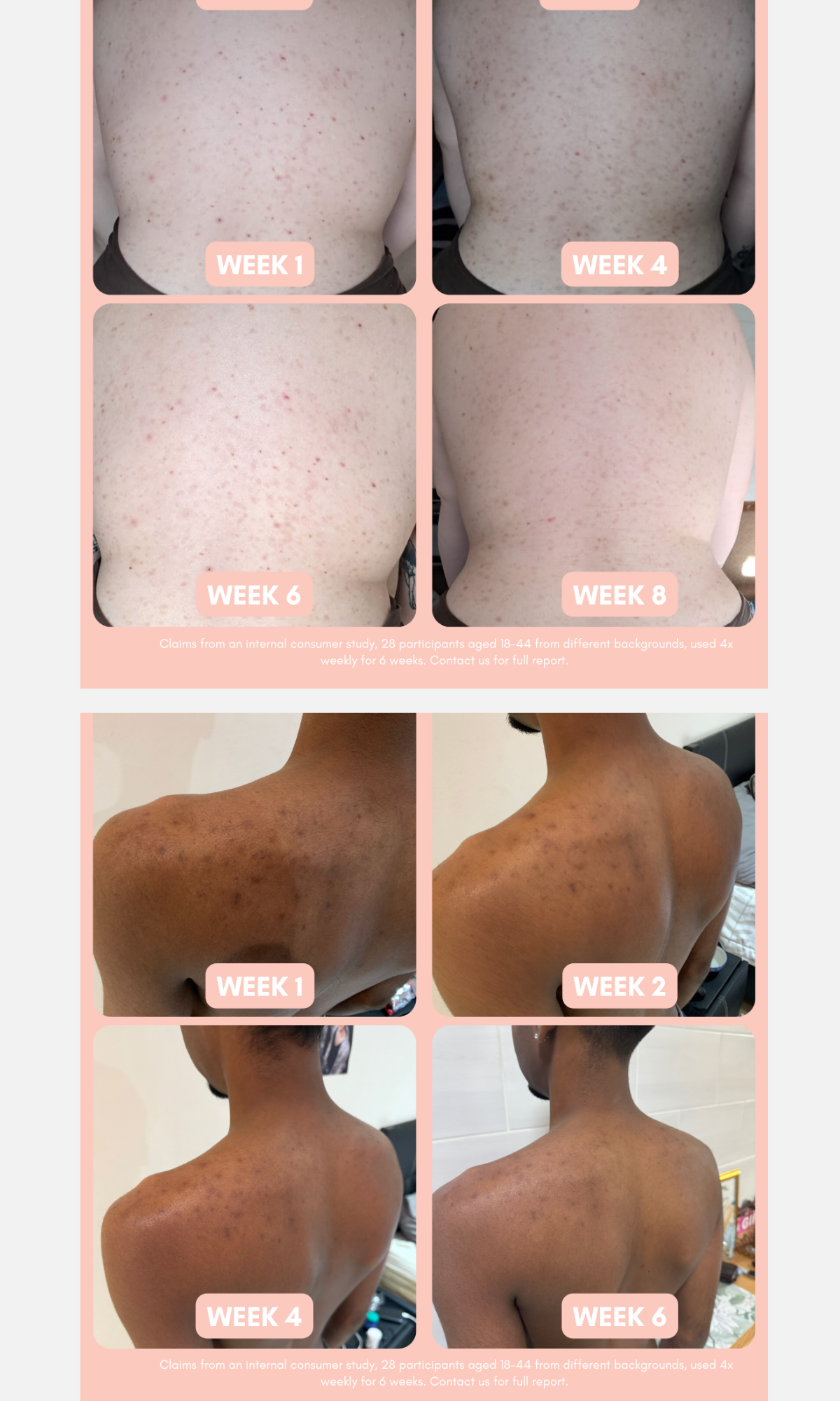 Standard Beauty - Pigmentation Buster Tissue Oil 100ml