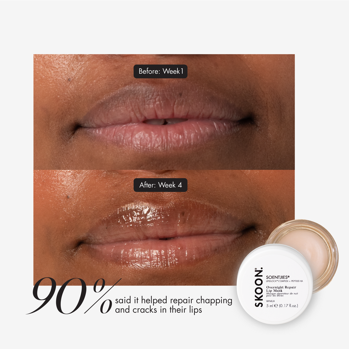 SKOON - Dream Lips Set Soenjties FullPout Hydrating Lip Balm 8ML + Soentjies Overnight Repair Lip Mask 5ml